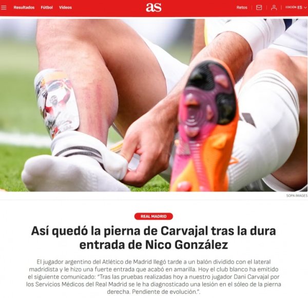 疼！卡瓦哈尔受伤一会儿：小腿被冈萨雷斯鞋钉蹬出三谈血痕